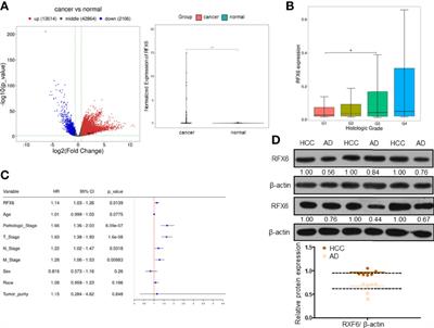Inhibition of <mark class="highlighted">RFX6</mark> Suppresses the Invasive Ability of Tumor Cells Through the Notch Pathway and Affects Tumor Immunity in Hepatocellular Carcinoma